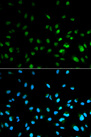HDAC3 Antibody - Immunofluorescence analysis of MCF7 cells.