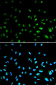 HDAC3 Antibody - Immunofluorescence analysis of MCF7 cells.
