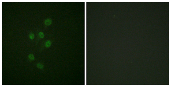 HDAC3 Antibody - Immunofluorescence analysis of A549 cells, using HDAC3 (Phospho-Ser424) Antibody. The picture on the right is blocked with the phospho peptide.