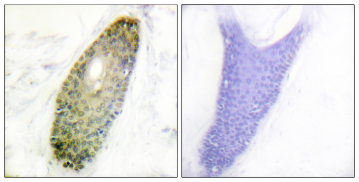 HDAC3 Antibody - Immunohistochemistry analysis of paraffin-embedded human skin, using HDAC3 (Phospho-Ser424) Antibody. The picture on the right is blocked with the phospho peptide.