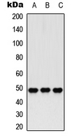 HDAC3 Antibody - Western blot analysis of Histone Deacetylase 3 (pS424) expression in HeLa (A); K562 (B); NIH3T3 (C) whole cell lysates.