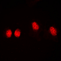 HDAC3 Antibody - Immunofluorescent analysis of Histone Deacetylase 3 (pS424) staining in HeLa cells. Formalin-fixed cells were permeabilized with 0.1% Triton X-100 in TBS for 5-10 minutes and blocked with 3% BSA-PBS for 30 minutes at room temperature. Cells were probed with the primary antibody in 3% BSA-PBS and incubated overnight at 4 ??C in a humidified chamber. Cells were washed with PBST and incubated with a DyLight 594-conjugated secondary antibody (red) in PBS at room temperature in the dark. DAPI was used to stain the cell nuclei (blue).