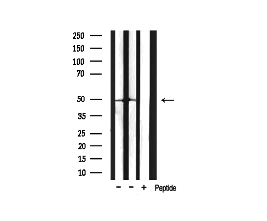 HDAC3 Antibody - Western blot analysis of Phospho-HDAC3 (Ser424) antibody expression in mouse lung and mouse brain tissues lysates. The lane on the right is treated with the antigen-specific peptide.