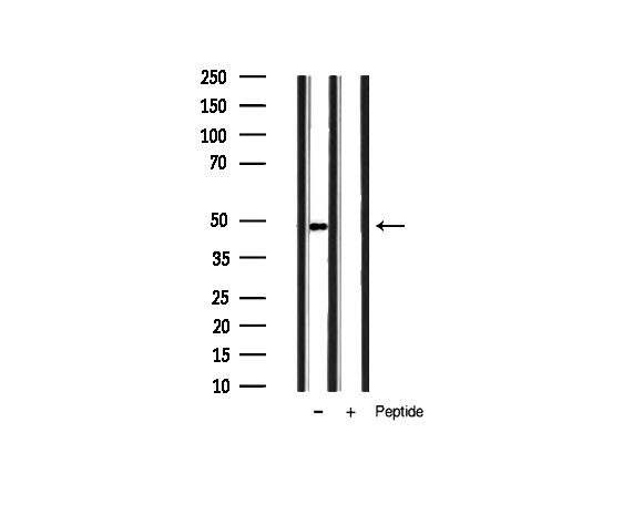 HDAC3 Antibody - Western blot analysis of extracts of rat spleen tissue lysates using Phospho-HDAC3 (Ser424) antibody.