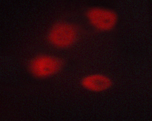 HDAC3 Antibody - Staining A549 cells by IF/ICC. The samples were fixed with PFA and permeabilized in 0.1% saponin prior to blocking in 10% serum for 45 min at 37°C. The primary antibody was diluted 1/400 and incubated with the sample for 1 hour at 37°C. A Alexa Fluor® 594 conjugated goat polyclonal to rabbit IgG (H+L), diluted 1/600 was used as secondary antibody.