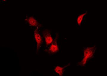 HDAC3 Antibody - Staining NIH-3T3 cells by IF/ICC. The samples were fixed with PFA and permeabilized in 0.1% Triton X-100, then blocked in 10% serum for 45 min at 25°C. The primary antibody was diluted at 1:200 and incubated with the sample for 1 hour at 37°C. An Alexa Fluor 594 conjugated goat anti-rabbit IgG (H+L) Ab, diluted at 1/600, was used as the secondary antibody.