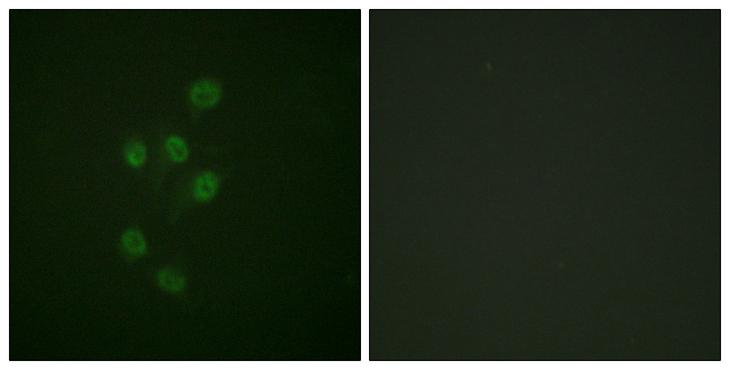 HDAC3 Antibody - P-peptide - + Immunofluorescence analysis of A549 cells, using HDAC3 (Phospho-Ser424) antibody.