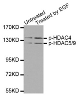 HDAC4/5/9 Antibody - Western blot analysis of extracts from 293 cells untreated or treated with EGF.