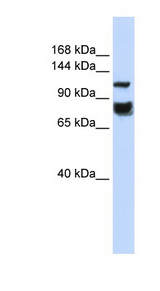 HDAC4 Antibody - HDAC4 antibody Western blot of HeLa lysate. This image was taken for the unconjugated form of this product. Other forms have not been tested.