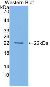 HDAC4 Antibody - Western blot of HDAC4 antibody.