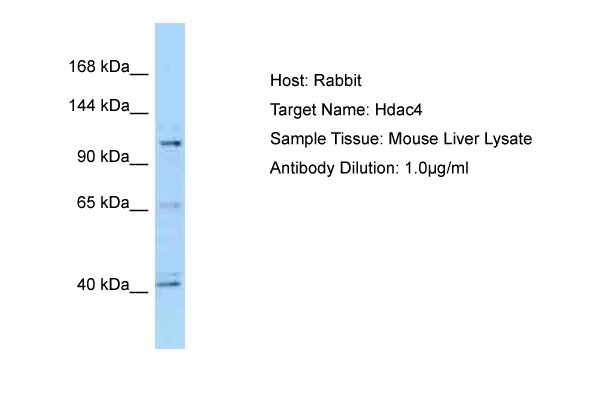 HDAC4 Antibody -  This image was taken for the unconjugated form of this product. Other forms have not been tested.