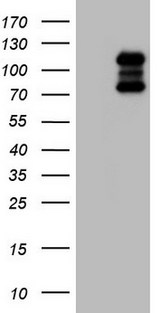 HDAC4 Antibody - HEK293T cells were transfected with the pCMV6-ENTRY control (Left lane) or pCMV6-ENTRY HDAC4 (Right lane) cDNA for 48 hrs and lysed. Equivalent amounts of cell lysates (5 ug per lane) were separated by SDS-PAGE and immunoblotted with anti-HDAC4.
