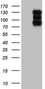 HDAC4 Antibody - HEK293T cells were transfected with the pCMV6-ENTRY control (Left lane) or pCMV6-ENTRY HDAC4 (Right lane) cDNA for 48 hrs and lysed. Equivalent amounts of cell lysates (5 ug per lane) were separated by SDS-PAGE and immunoblotted with anti-HDAC4.