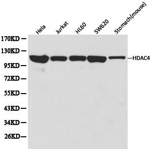 HDAC4 Antibody - Western blot of HDAC4 pAb in extracts from Hela, Jurkat, HL60, SW620 cells and mouse stomach tissue.