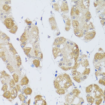 HDAC4 Antibody - Immunohistochemistry of paraffin-embedded human stomach using HDAC4 antibody at dilution of 1:100 (40x lens).