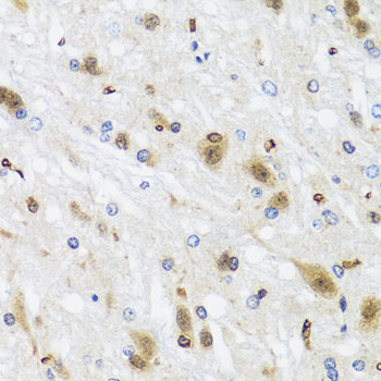 HDAC4 Antibody - Immunohistochemistry of paraffin-embedded rat brain using HDAC4 antibody at dilution of 1:100 (40x lens).