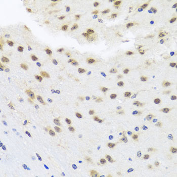 HDAC4 Antibody - Immunohistochemistry of paraffin-embedded mouse brain using HDAC4 antibody at dilution of 1:100 (40x lens).