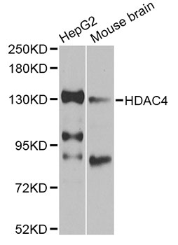 HDAC4 Antibody - Western blot analysis of extracts of various cell lines, using HDAC4 antibody at 1:1000 dilution. The secondary antibody used was an HRP Goat Anti-Rabbit IgG (H+L) at 1:10000 dilution. Lysates were loaded 25ug per lane and 3% nonfat dry milk in TBST was used for blocking. An ECL Kit was used for detection and the exposure time was 30s.