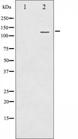 HDAC4 Antibody - Western blot analysis of HDAC4 expression in HeLa whole cells lysates. The lane on the left is treated with the antigen-specific peptide.