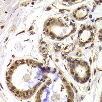 HDAC4 Antibody - Immunohistochemistry of paraffin-embedded Human breast using HDAC4 Polyclonal Antibody at dilution of 1:100 (40x lens).