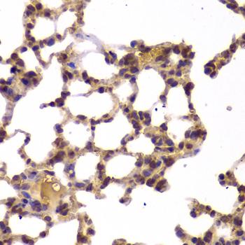 HDAC4 Antibody - Immunohistochemistry of paraffin-embedded Mouse lung using HDAC4 Polyclonal Antibody at dilution of 1:100 (40x lens).