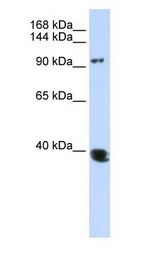 HDAC4 Antibody - HDAC4 antibody Western Blot of HeLa cell lysate.  This image was taken for the unconjugated form of this product. Other forms have not been tested.