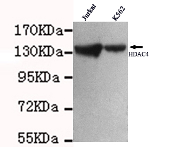 HDAC4 Antibody - Western blot detection of HDAC4 in Jurkat&K562 cell lysates using HDAC4 antibody (1:1000 diluted).