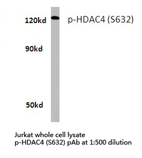 HDAC4 Antibody - Western blot of p-HDAC4 (S632) pAb in extracts from Jurkat cells.