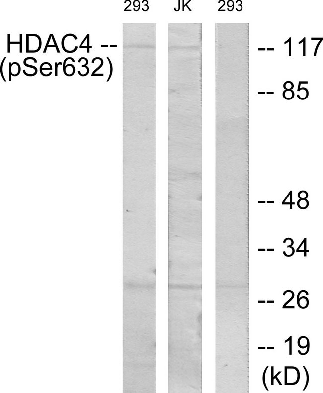 HDAC4 Antibody - Western blot analysis of lysates from 293 cells treated with etoposide 25uM 1hour and Jurkat cells treated with etoposide 25uM 24hours, using HDAC4 (Phospho-Ser632) Antibody. The lane on the right is blocked with the phospho peptide.