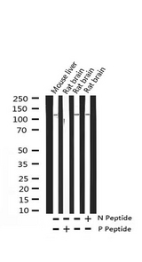 HDAC4 Antibody - Western blot analysis of Phospho-HDAC4 (Ser632) expression in various lysates