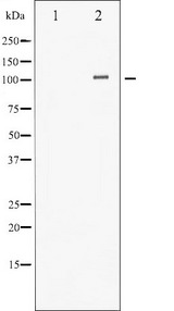 HDAC4 Antibody - Western blot analysis of HDAC4 phosphorylation expression in CalyculinA treated Jurkat whole cells lysates. The lane on the left is treated with the antigen-specific peptide.