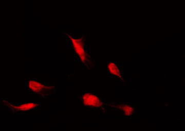 HDAC4 Antibody - Staining HeLa cells by IF/ICC. The samples were fixed with PFA and permeabilized in 0.1% Triton X-100, then blocked in 10% serum for 45 min at 25°C. The primary antibody was diluted at 1:200 and incubated with the sample for 1 hour at 37°C. An Alexa Fluor 594 conjugated goat anti-rabbit IgG (H+L) Ab, diluted at 1/600, was used as the secondary antibody.
