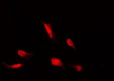 HDAC4 Antibody - Staining HeLa cells by IF/ICC. The samples were fixed with PFA and permeabilized in 0.1% Triton X-100, then blocked in 10% serum for 45 min at 25°C. The primary antibody was diluted at 1:200 and incubated with the sample for 1 hour at 37°C. An Alexa Fluor 594 conjugated goat anti-rabbit IgG (H+L) Ab, diluted at 1/600, was used as the secondary antibody.
