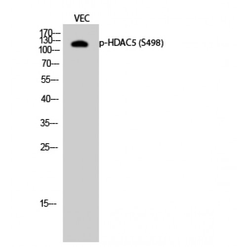 HDAC5 Antibody - Western blot of Phospho-HDAC5 (S498) antibody