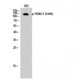 HDAC5 Antibody - Western blot of Phospho-HDAC5 (S498) antibody
