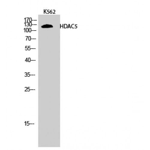HDAC5 Antibody - Western blot of HDAC5 antibody