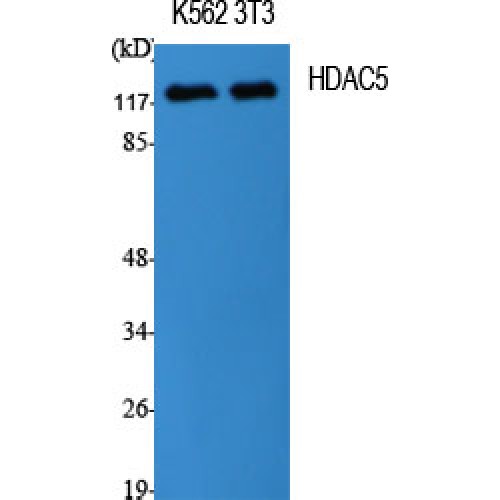 HDAC5 Antibody - Western blot of HDAC5 antibody