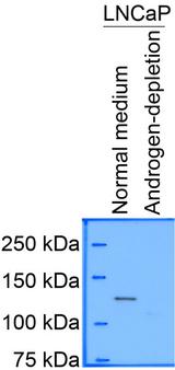 HDAC5 Antibody - Western Blot: HDAC5 Antibody - LNCaP cells with normal medium and with androgen depletion. Image from verified customer review.