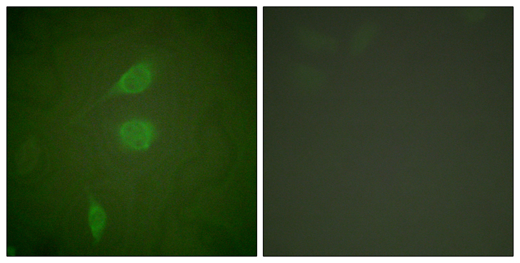 HDAC5 Antibody - Immunofluorescence analysis of NIH/3T3 cells, using HDAC5 Antibody. The picture on the right is blocked with the synthesized peptide.