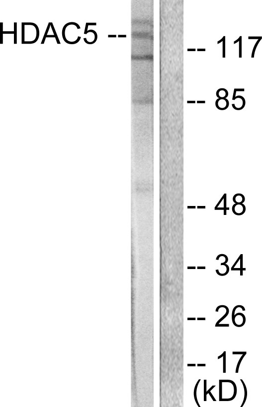 HDAC5 Antibody - Western blot analysis of lysates from HepG2 cells, treated with PMA 125ng/ml 30', using HDAC5 Antibody. The lane on the right is blocked with the synthesized peptide.