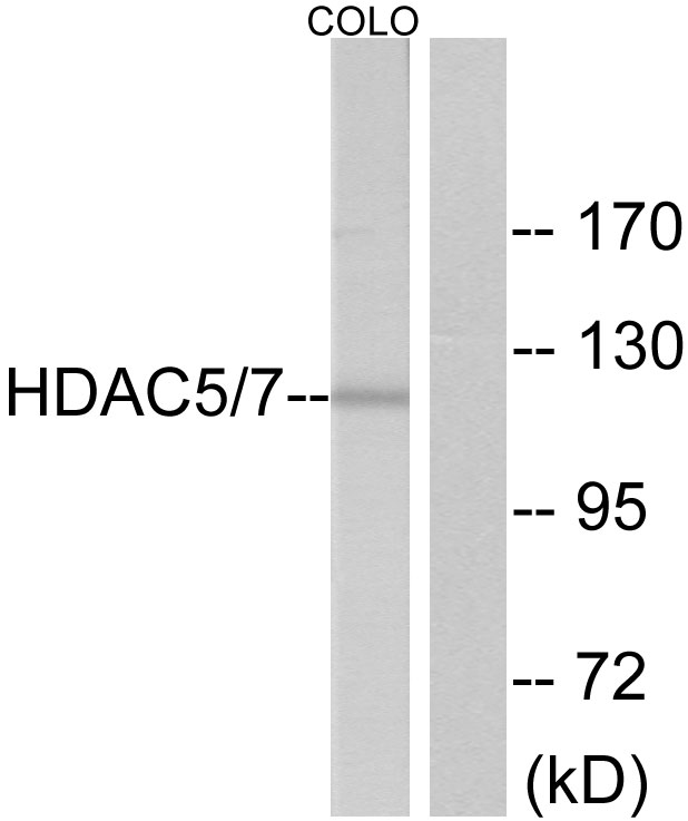 HDAC5 Antibody - Western blot analysis of lysates from NIH/3T3 cells, using HDAC5 Antibody. The lane on the right is blocked with the synthesized peptide.