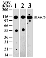 HDAC5 Antibody - Western blot of HDAC5 in 293 (lane 1), Jurkat (lane 2) and NIH-3T3 (lane 3) cell lysate with antibody.