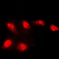 HDAC5 Antibody - Immunofluorescent analysis of Histone Deacetylase 5 staining in Jurkat cells. Formalin-fixed cells were permeabilized with 0.1% Triton X-100 in TBS for 5-10 minutes and blocked with 3% BSA-PBS for 30 minutes at room temperature. Cells were probed with the primary antibody in 3% BSA-PBS and incubated overnight at 4 C in a humidified chamber. Cells were washed with PBST and incubated with a DyLight 594-conjugated secondary antibody (red) in PBS at room temperature in the dark. DAPI was used to stain the cell nuclei (blue).
