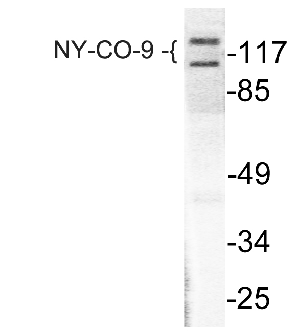 HDAC5 Antibody - Western blot of HDAC5 (E1106) pAb in extracts from HepG2 treated with PMA 125ng/ml 30'.