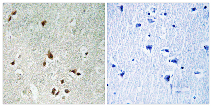 HDAC5 Antibody - Immunohistochemistry analysis of paraffin-embedded human brain tissue, using HDAC5 Antibody. The picture on the right is blocked with the synthesized peptide.