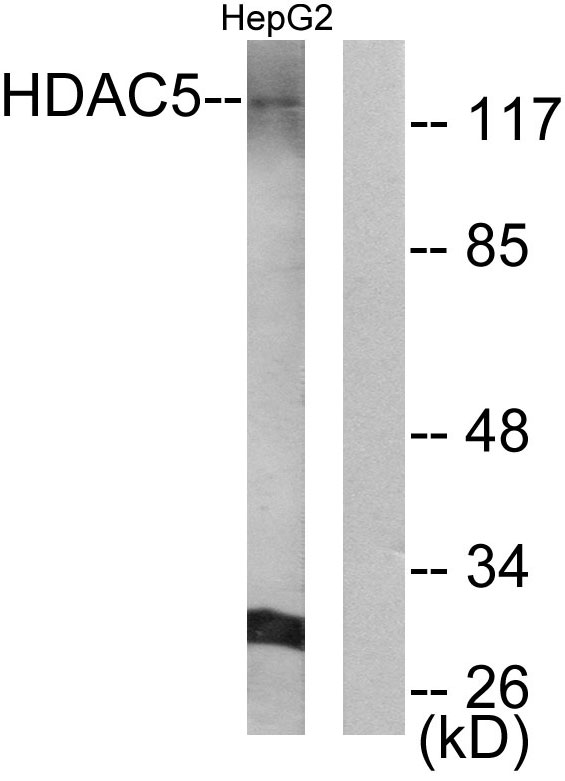 HDAC5 Antibody - Western blot analysis of lysates from HepG2 cells, using HDAC5 Antibody. The lane on the right is blocked with the synthesized peptide.