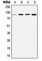 HDAC5 Antibody - Western blot analysis of Histone Deacetylase 5 expression in MCF7 (A); HeLa (B); NIH3T3 (C); H9C2 (D) whole cell lysates.