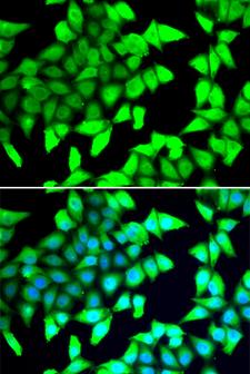 HDAC5 Antibody - Immunofluorescence analysis of A549 cells.
