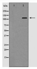 HDAC5 Antibody - Western blot of HDAC5 expression in HepG2 cell extract