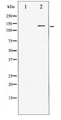 HDAC5 Antibody - Western blot of HDAC5 expression in HepG2 whole cell lysates,The lane on the left is treated with the antigen-specific peptide.